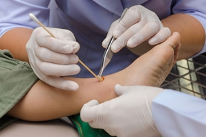 Wound Care on Children’s Feet
